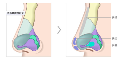 硅膠隆鼻